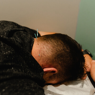 acupuncture Cedar Rapids, holistic acupuncture near me, natural pain relief acupuncture, stress relief acupuncture, digestive support acupuncture, allergy relief acupuncture Cedar Rapids, labor inducing acupuncture, acupuncture for sleep and anxiety