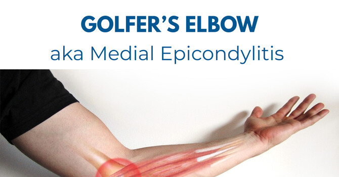 Golfer’s Elbow: How Active Release Technique (ART) Can Get You Back in the Game image